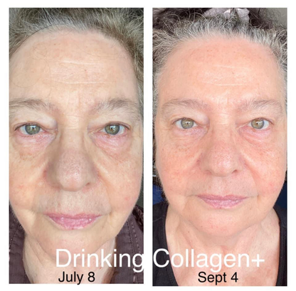 Collagen +