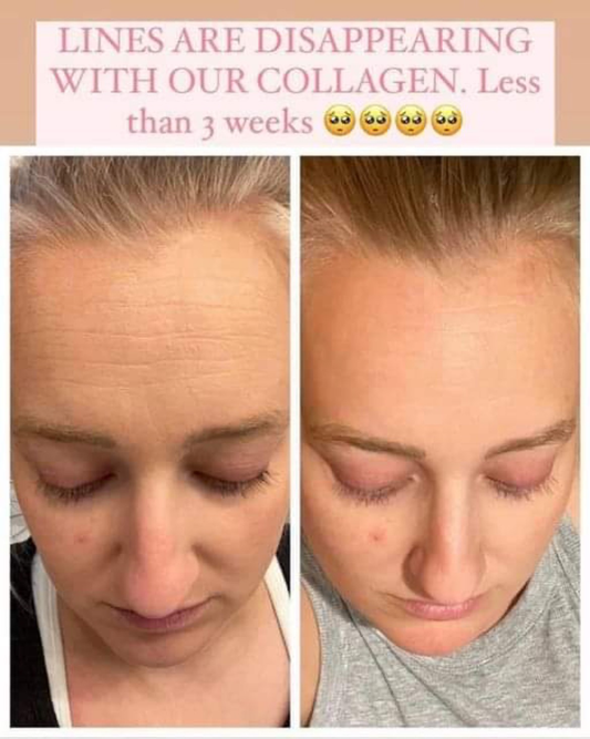 Collagen +
